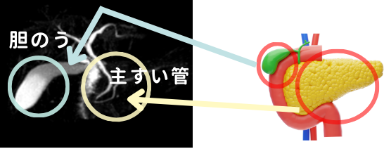 すい臓がんドック（+APOA2）