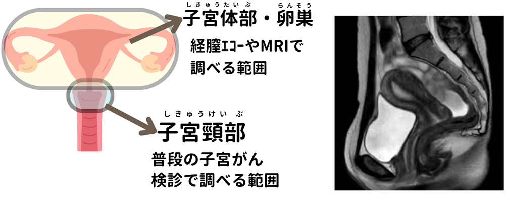 すい臓がんドック（+APOA2）