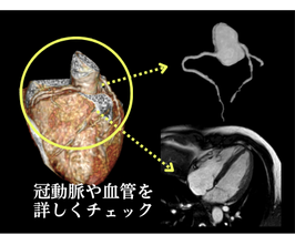 心臓MRI